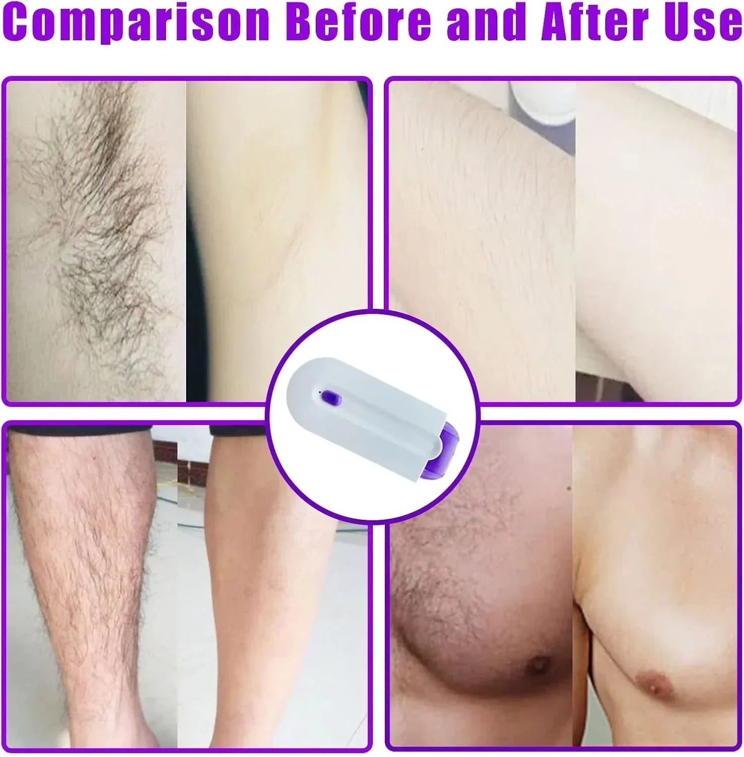FINISHING TOUCH Instant Pain Free Hair Remover - shopping-spot
